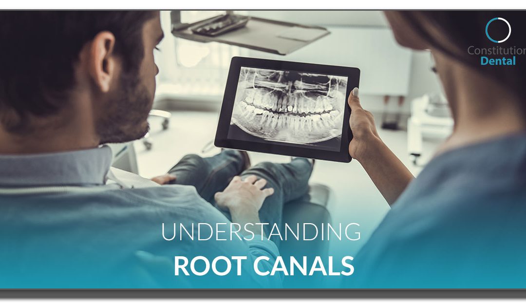 understanding root canal