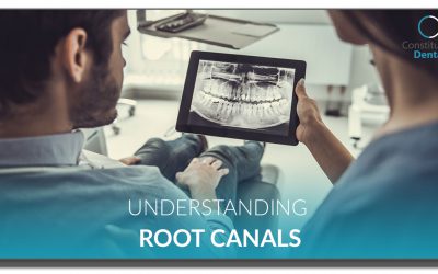 Understanding Root Canals