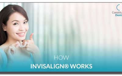 How Invisalign® Works