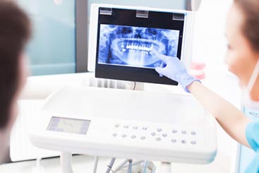 inlays-and-onlays Tooth examination - ottawa Inlays & Onlays