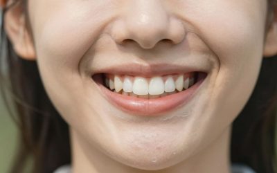 Best Age for Invisalign clear aligners: When Is the Right Time to Start?